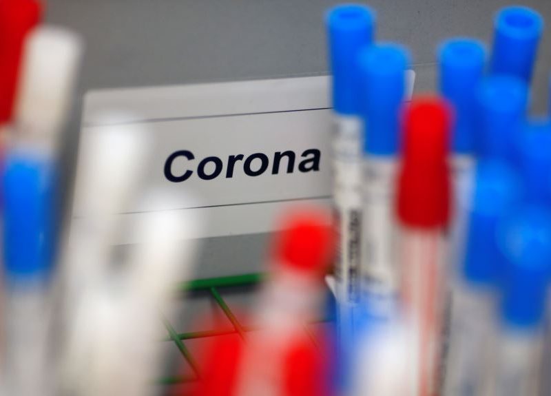 Moscú, primera ciudad del mundo en ofrecer test de anticuerpos del COVID-19