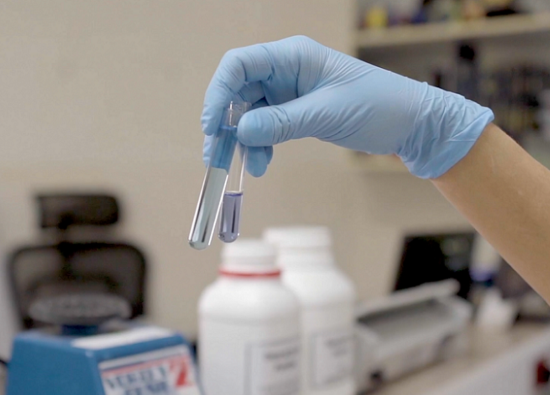 Rusia registra un fármaco contra la covid-19 a base de plasma de recuperados