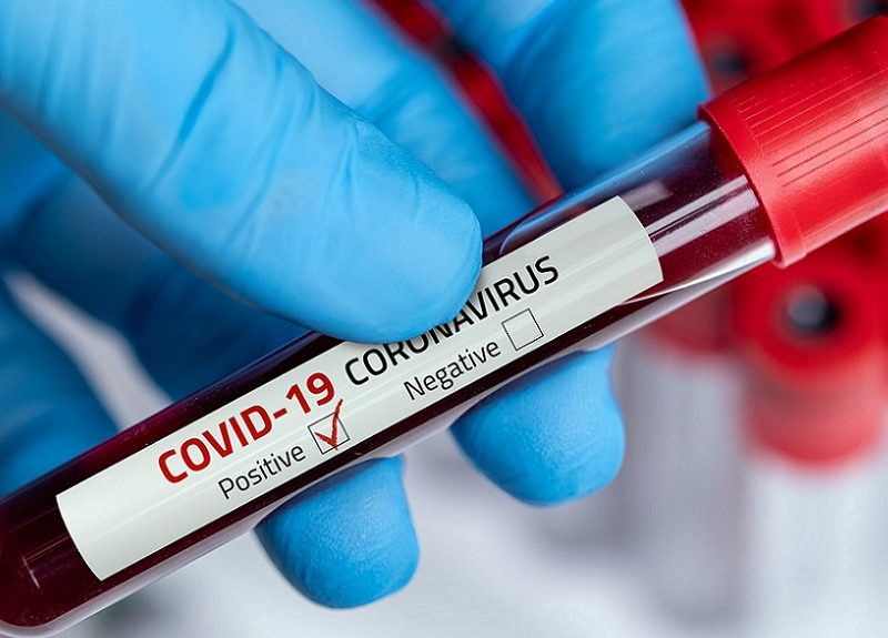 Siete países ahora tienen más de un millón de casos de COVID-19